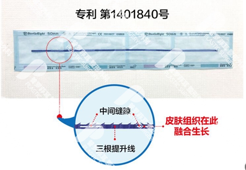 普罗菲耳朴明旭院长小切口三重提升线示意图